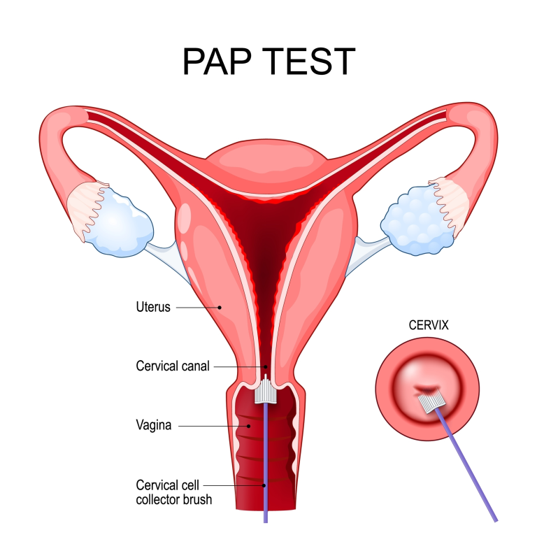 pap test